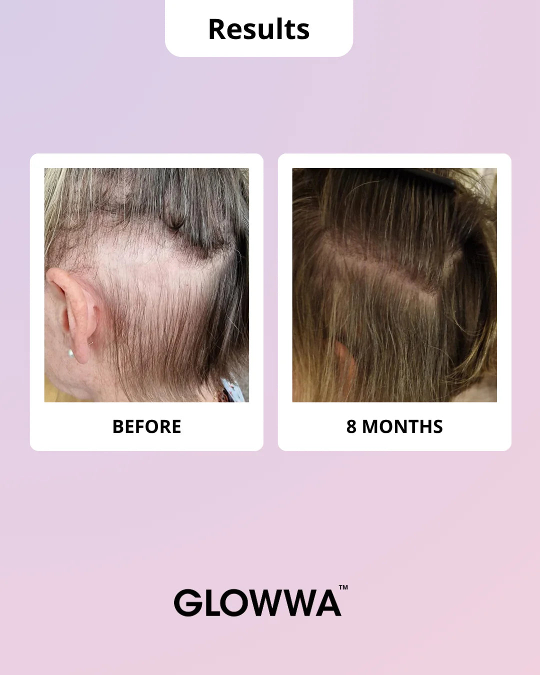 Glowwa Hair Vitamins - Meno 60 Capsules